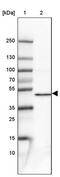 Protein Phosphatase Methylesterase 1 antibody, PA5-60545, Invitrogen Antibodies, Western Blot image 