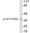 Linker For Activation Of T Cells antibody, LS-C291505, Lifespan Biosciences, Western Blot image 