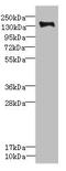 Plexin B2 antibody, LS-C676280, Lifespan Biosciences, Western Blot image 