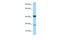 Syntaxin 7 antibody, A07855, Boster Biological Technology, Western Blot image 