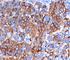 Melan-A antibody, V2121IHC-7ML, NSJ Bioreagents, Immunohistochemistry paraffin image 