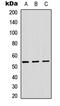 ADAM Like Decysin 1 antibody, GTX54922, GeneTex, Western Blot image 