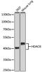 Histone Deacetylase 8 antibody, GTX57746, GeneTex, Western Blot image 