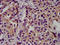 Carcinoembryonic Antigen Related Cell Adhesion Molecule 16 antibody, LS-C674257, Lifespan Biosciences, Immunohistochemistry paraffin image 