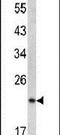 Signal Peptidase Complex Subunit 3 antibody, PA5-13630, Invitrogen Antibodies, Western Blot image 