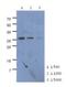 Carboxymethylenebutenolidase Homolog antibody, NBP2-22618, Novus Biologicals, Western Blot image 