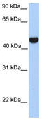 Reticulon 4 antibody, TA341874, Origene, Western Blot image 