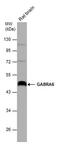 Gamma-Aminobutyric Acid Type A Receptor Alpha6 Subunit antibody, PA5-78387, Invitrogen Antibodies, Western Blot image 