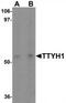 Tweety Family Member 1 antibody, TA319973, Origene, Western Blot image 