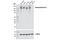 DNA Topoisomerase II Alpha antibody, 12286S, Cell Signaling Technology, Western Blot image 