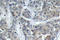 Stathmin 1 antibody, LS-C177662, Lifespan Biosciences, Immunohistochemistry frozen image 