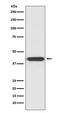 Histone Deacetylase 8 antibody, M01843, Boster Biological Technology, Western Blot image 