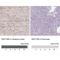 Wnt Family Member 10B antibody, NBP2-49165, Novus Biologicals, Immunohistochemistry paraffin image 