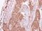 ACK1 antibody, NBP1-32311, Novus Biologicals, Immunohistochemistry paraffin image 