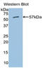 Aldehyde Dehydrogenase 7 Family Member A1 antibody, LS-C300754, Lifespan Biosciences, Western Blot image 