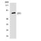 Zona Pellucida Glycoprotein 1 antibody, LS-C292231, Lifespan Biosciences, Western Blot image 