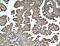 Serpin Family A Member 5 antibody, 66030-1-Ig, Proteintech Group, Immunohistochemistry paraffin image 
