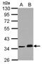 Protein Phosphatase, Mg2+/Mn2+ Dependent 1J antibody, NBP2-19902, Novus Biologicals, Western Blot image 