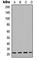 Troponin T1, Slow Skeletal Type antibody, abx133094, Abbexa, Western Blot image 