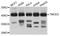 Tropomodulin 3 antibody, STJ25880, St John