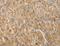 Vitronectin antibody, LS-C404632, Lifespan Biosciences, Immunohistochemistry frozen image 