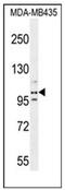Platelet Endothelial Aggregation Receptor 1 antibody, AP53251PU-N, Origene, Western Blot image 