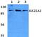 S22A2 antibody, PA5-37290, Invitrogen Antibodies, Western Blot image 