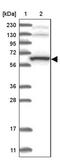 THUMP Domain Containing 3 antibody, PA5-57554, Invitrogen Antibodies, Western Blot image 