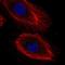 Interleukin 20 Receptor Subunit Beta antibody, HPA063914, Atlas Antibodies, Immunofluorescence image 