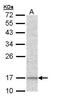 NADH:Ubiquinone Oxidoreductase Subunit A12 antibody, PA5-22035, Invitrogen Antibodies, Western Blot image 