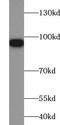 Villin 1 antibody, FNab09406, FineTest, Western Blot image 