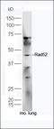 RAD52 Homolog, DNA Repair Protein antibody, orb13670, Biorbyt, Western Blot image 