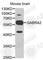 Gamma-Aminobutyric Acid Type A Receptor Alpha2 Subunit antibody, A1803, ABclonal Technology, Western Blot image 