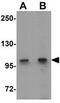 Coronin 7 antibody, GTX31451, GeneTex, Western Blot image 