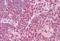 Interferon Regulatory Factor 4 antibody, MBS243705, MyBioSource, Immunohistochemistry paraffin image 