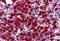 Cytidine Deaminase antibody, MBS241714, MyBioSource, Immunohistochemistry paraffin image 