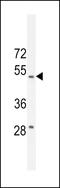 Reticulon 4 Interacting Protein 1 antibody, 55-409, ProSci, Western Blot image 