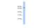 Amiloride-sensitive cation channel 4 antibody, A09530, Boster Biological Technology, Western Blot image 