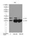 Microtubule Associated Protein 1 Light Chain 3 Alpha antibody, 12135-1-AP, Proteintech Group, Western Blot image 