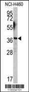 Engrailed Homeobox 2 antibody, 62-926, ProSci, Western Blot image 