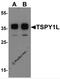 Testis Specific Protein Y-Linked 1 antibody, 7121, ProSci, Western Blot image 