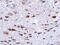 BORA Aurora Kinase A Activator antibody, 5107, ProSci, Immunohistochemistry paraffin image 