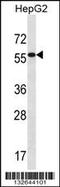 Aldehyde Dehydrogenase 3 Family Member B2 antibody, 56-702, ProSci, Western Blot image 