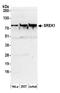 Splicing Regulatory Glutamic Acid And Lysine Rich Protein 1 antibody, A305-105A, Bethyl Labs, Western Blot image 