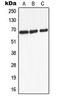 Adrenoceptor Beta 2 antibody, LS-C353893, Lifespan Biosciences, Western Blot image 