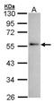 Annexin A11 antibody, NB100-78588, Novus Biologicals, Western Blot image 