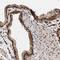 ING2 antibody, PA5-54434, Invitrogen Antibodies, Immunohistochemistry paraffin image 