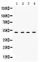 Ribonucleotide Reductase Regulatory Subunit M2 antibody, PA5-79937, Invitrogen Antibodies, Western Blot image 