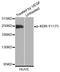 Kinase Insert Domain Receptor antibody, STJ22219, St John