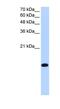 Basic Leucine Zipper ATF-Like Transcription Factor 2 antibody, NBP1-79267, Novus Biologicals, Western Blot image 